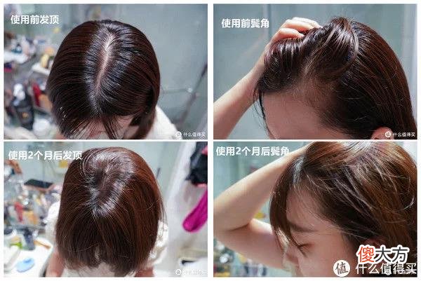 【时尚一点】脱发别焦虑，10个细节帮你改善！踩雷无数后，奉上9款亲测好用的防脱育发产品，附618入手好价