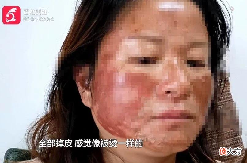 【就爱时尚】女子花7000多祛斑，却不想变成“关公脸”！美妆店：正常的……