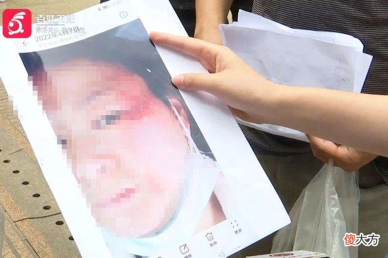 【就爱时尚】女子花7000多祛斑，却不想变成“关公脸”！美妆店：正常的……