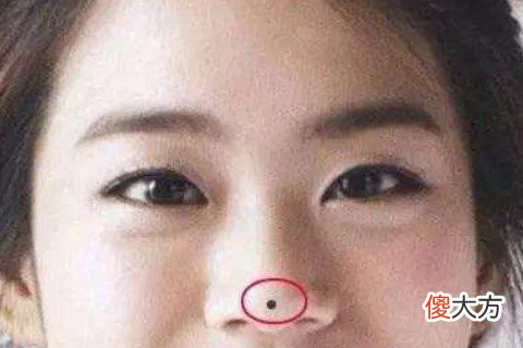 女人鼻子上的痣图解