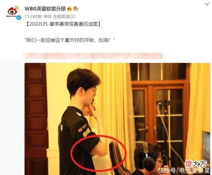 【游戏世界】WBG官方无意爆出TheShy手伤，疤痕触目惊心！随后却秒打码？