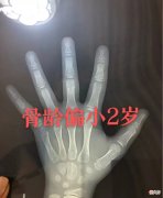 可惜长不高了 长不高了很难过