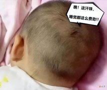 孩子睡觉出汗并非缺钙，了解4个原因3个步骤，让娃少出汗睡得香