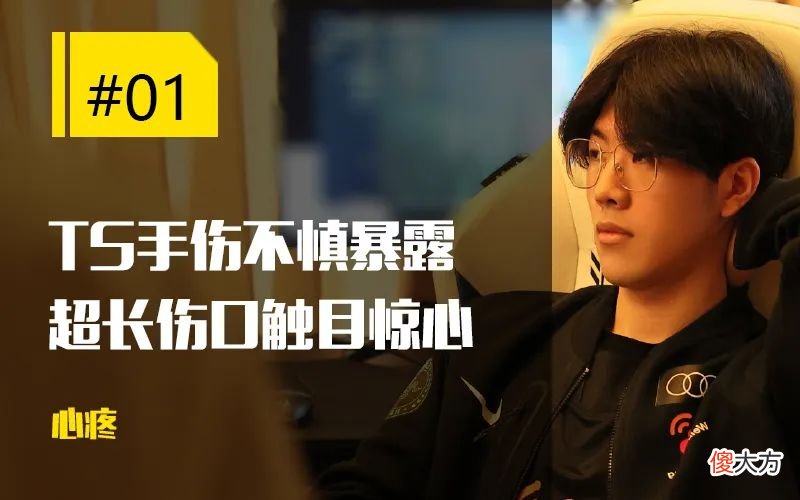 【游戏世界】【每日一撸】TheShy手伤不慎暴露触目惊心；阿水招牌德皇被打超鬼