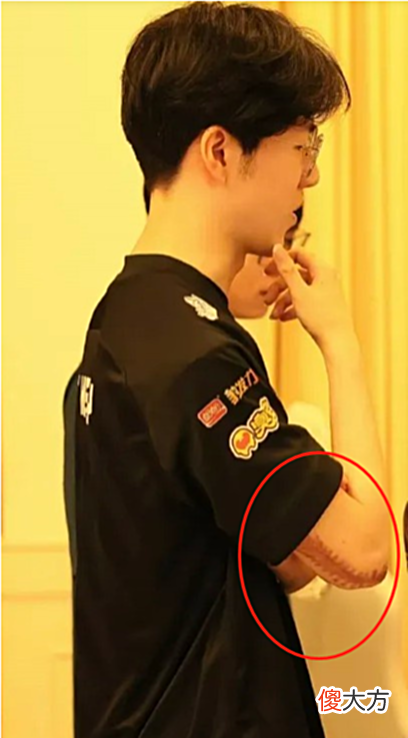 【游戏世界】每日一撸TheShy手伤不慎暴露触目惊心；阿水招牌德皇被打超鬼