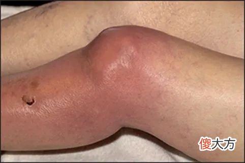 以为孩子在长高，一查竟然得了癌！有这4个症状，快带娃去医院！