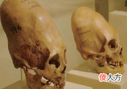 英国巨石阵有什么用 石柱有什么用