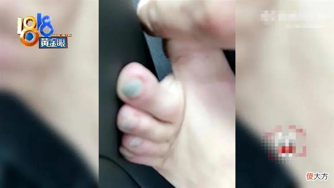 【时尚一点】男子花8450元买LV鞋，雨天穿出门，袜子、脚趾全绿了！