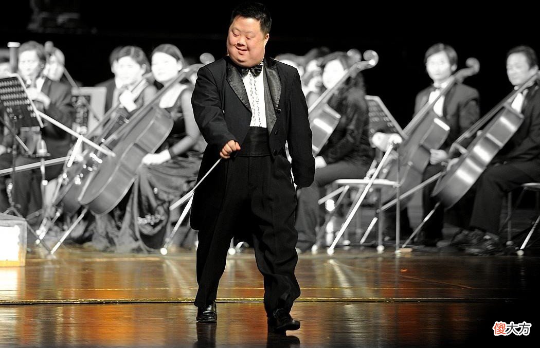 为什么唐氏综合征的人长相都一样？他们缺少来自遗传父母相貌的基因吗？