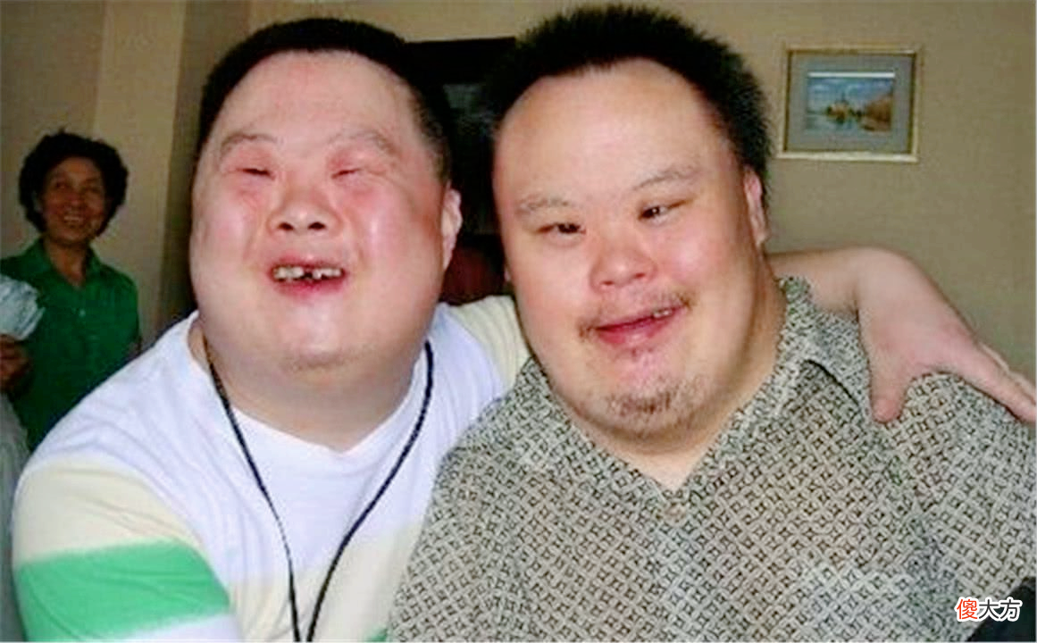 为什么唐氏综合征的人长相都一样？他们缺少来自遗传父母相貌的基因吗？