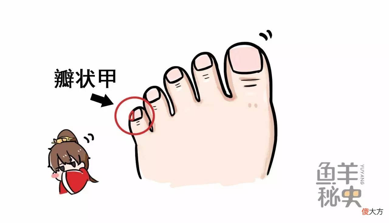 听说你是汉族人？来，脱下鞋看看你的小拇趾甲吧！