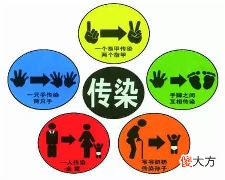 讨厌的灰指甲 灰指甲好烦