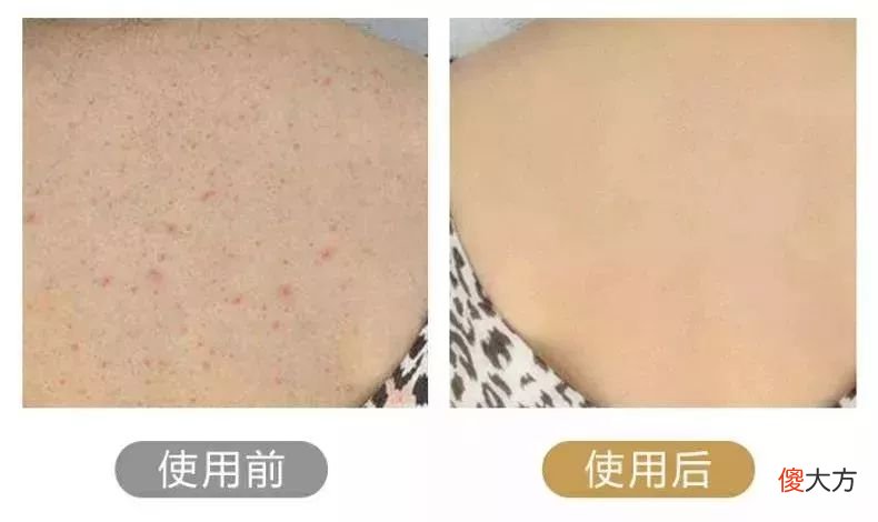 【时尚一点】洗澡时，够不到后背怎么办？教你正确做法，搓背干净不求人