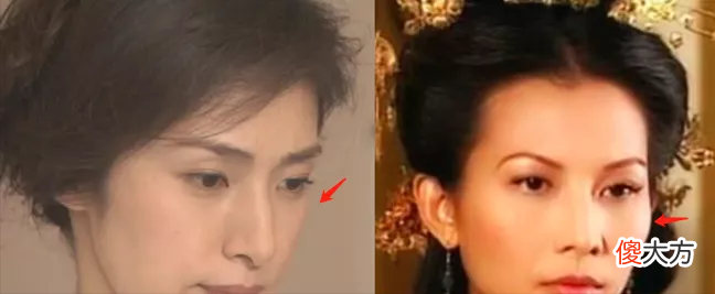 同样都是高颧骨 颧骨不一样高