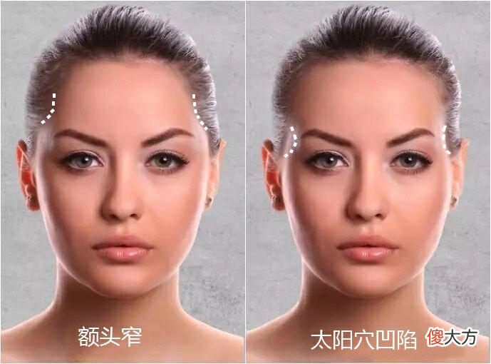 同样都是高颧骨 颧骨不一样高