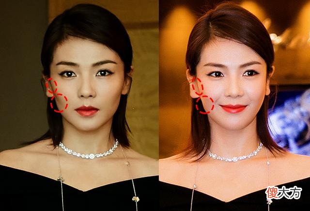 同样都是高颧骨 颧骨不一样高