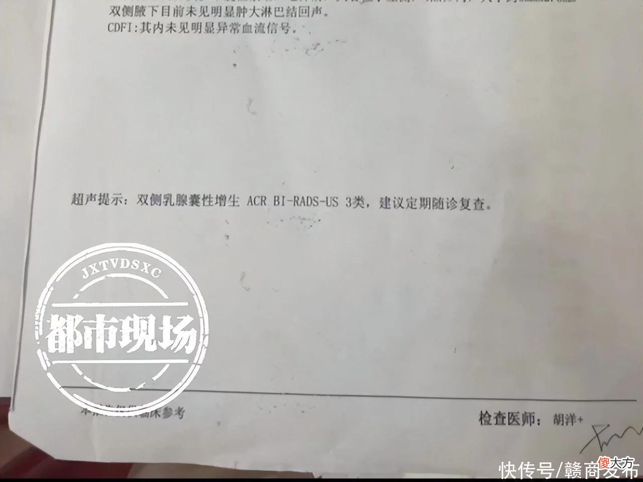 【就爱时尚】女子花6万做隆胸手术记录被涂改 南昌“格芮医美”被指严重违规操作