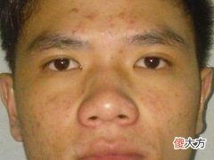 穷命男面相有何特点