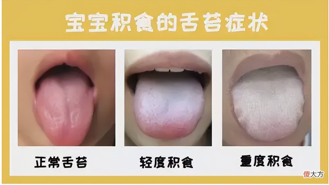4种情况暗示孩子可能已经积食了，家长莫慌，这样调理简单管用！