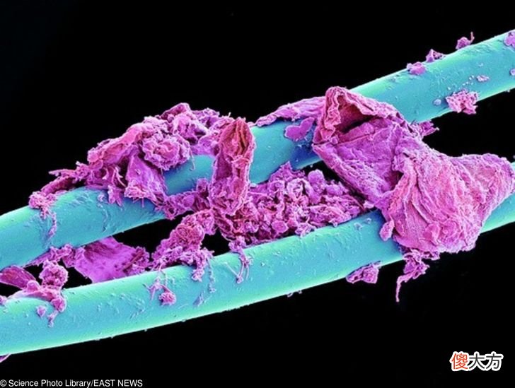 30张显微镜下拍摄到的照片 显微镜拍摄的图片