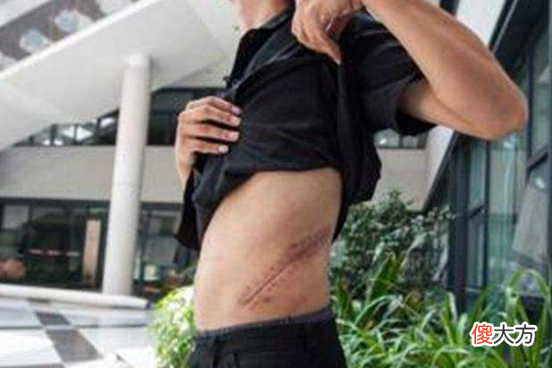 高中生王刚卖肾买苹果手机 卖肾买苹果手机的王刚