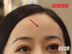 分析额头上有皱纹面相