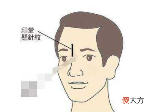 男人脾气暴躁的面相特征