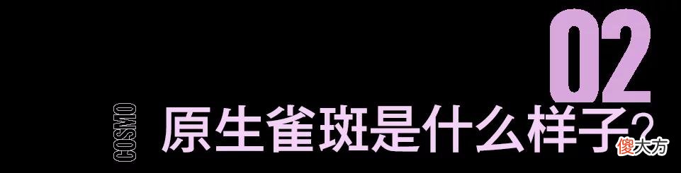 【就爱时尚】没有雀斑,就不叫ABG女孩啦?