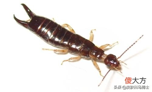 what耳屎能有什么作用？