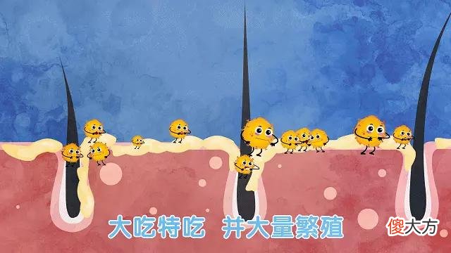 【就爱时尚】怕秃头，女子3个月不洗头！结果悲剧了