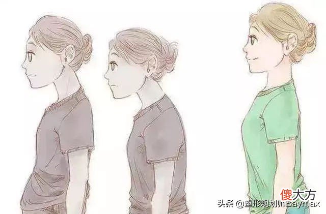 含胸驼背怎么改善 如何改善驼背含胸