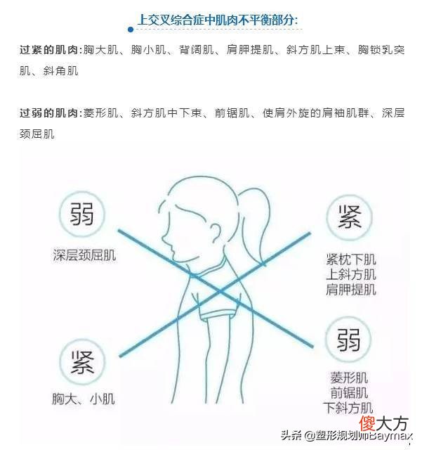 含胸驼背怎么改善 如何改善驼背含胸