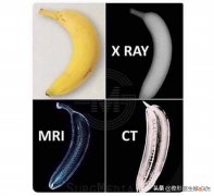 CT、核磁、B超的区别，通俗易懂