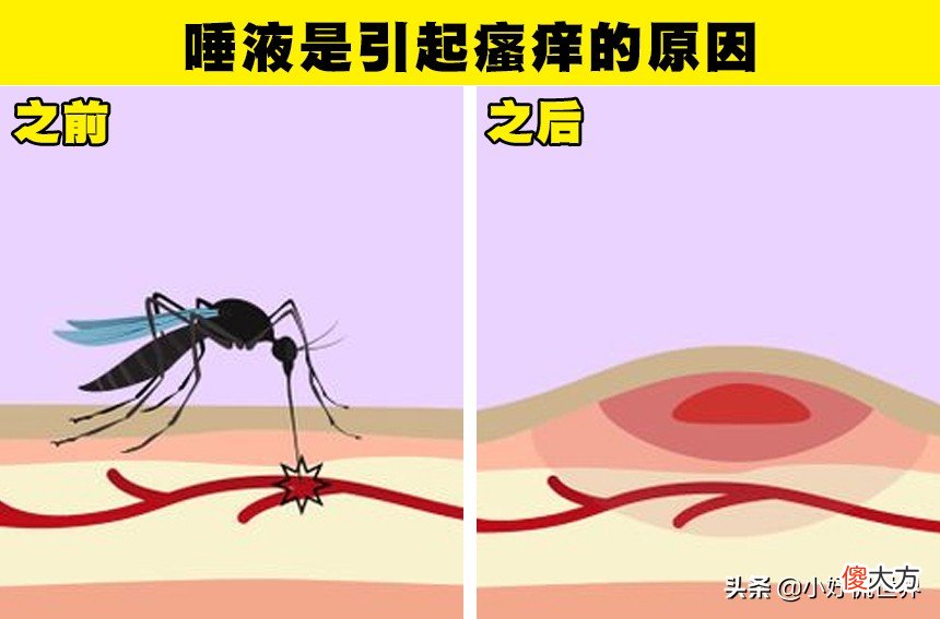 蚊子为什么会在耳边嗡嗡叫 蚊子为什么在耳边嗡嗡叫?