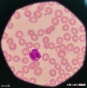 根据白细胞种类判断是感染类型 白细胞的分类有以下