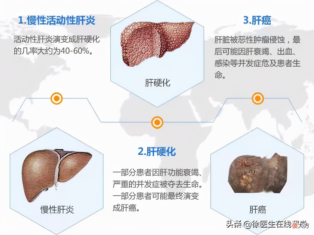 谷丙转氨酶和谷草转氨酶都偏高怎么办 谷丙转氨酶和谷草转氨酶都偏高怎么办?