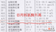 体检时发现谷丙转氨酶升高怎么办 体检发现谷丙转氨酶偏高怎么办