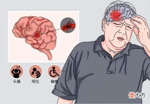 血压值高到多少才会引起脑出血 血压高到多少，才会诱发脑出血?医生给出参考值