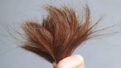 【时尚一点】头发干枯怎么回事？头发干枯是头发的问题，还是身体的问题