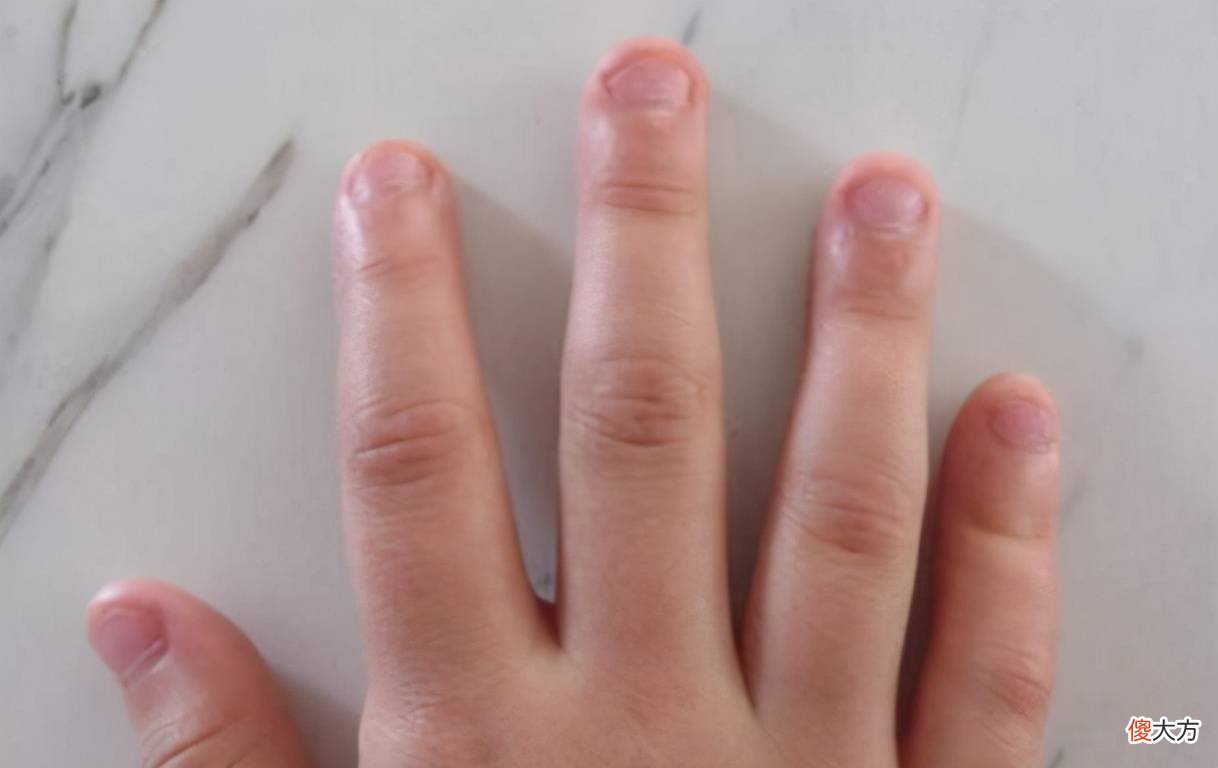 孩子从小喜欢“咬指甲”，时间久了会如何？通常会有3种结局