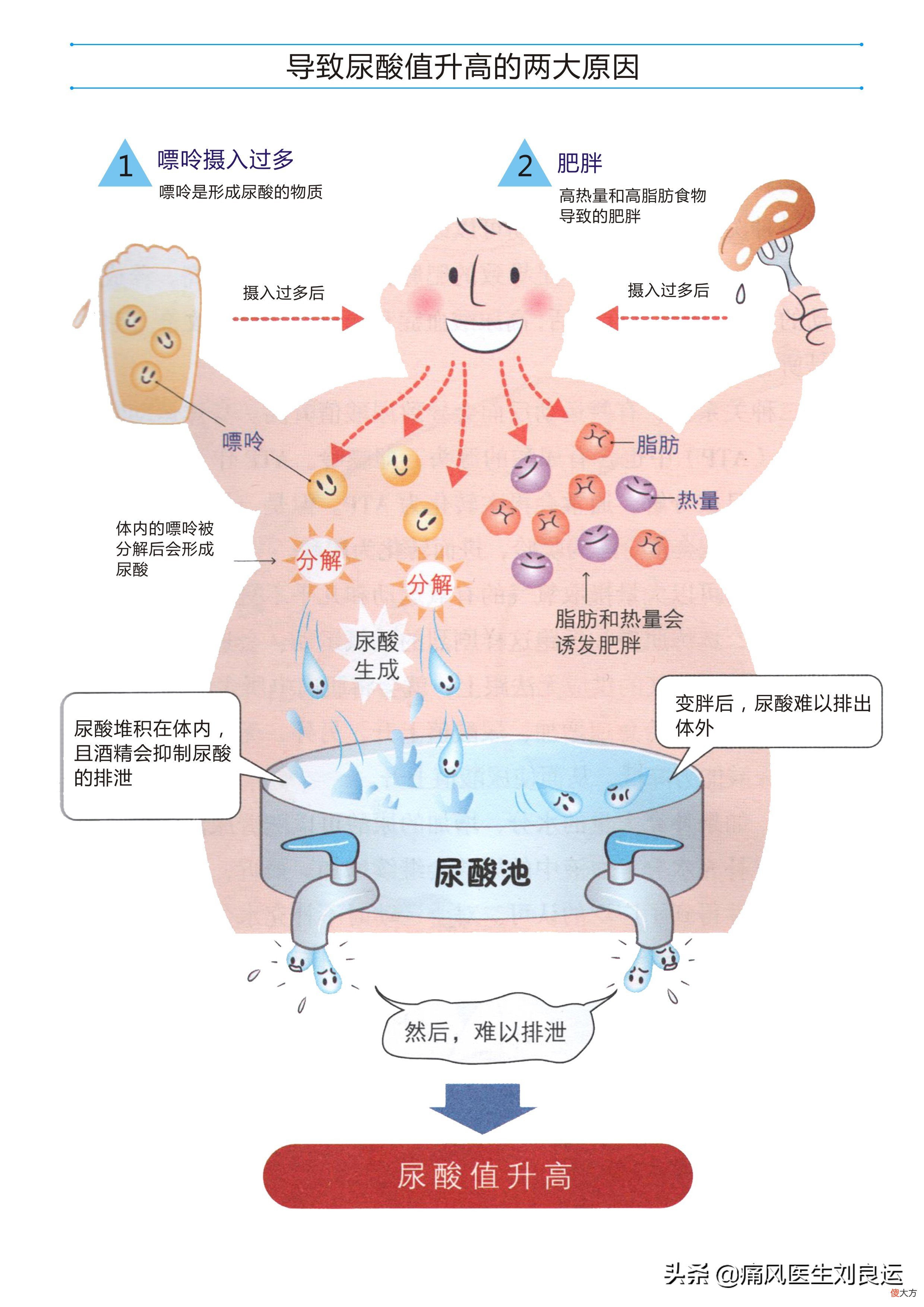痛风发生的物质基础是嘌呤代谢产生尿酸 引起痛风的尿酸是什么核苷酸代谢的产物