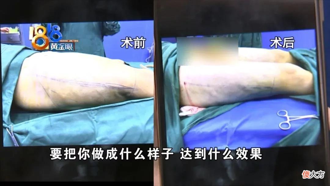 【就爱时尚】想要瘦成“筷子腿”  没能“立竿见影”？