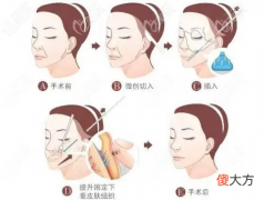 毛医生，我才24岁，皮肤这么松弛怎么办？ 非常病例