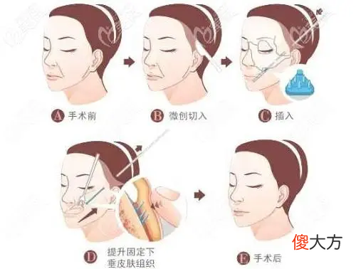 毛医生，我才24岁，皮肤这么松弛怎么办？ 非常病例