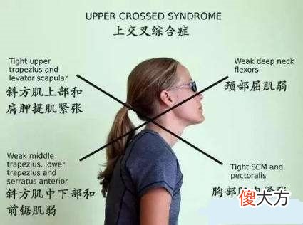 低头看手机对颈椎不好 低头看手机对颈椎的危害怎么解决