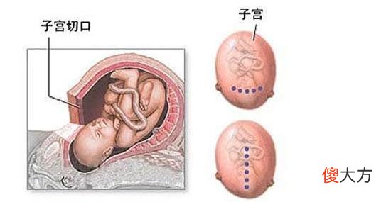 除了横切和竖切 纵切是横切还是竖切