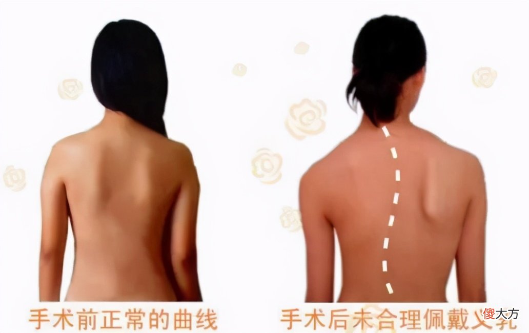 春季女神变美攻略，乳康姐妹如何挑选合适的义乳是关键