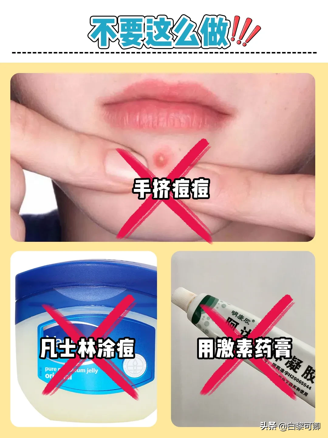 护肤小知识|开始爱美那会就研究护肤了，那时候皮肤还挺好，偶尔几颗小痘痘