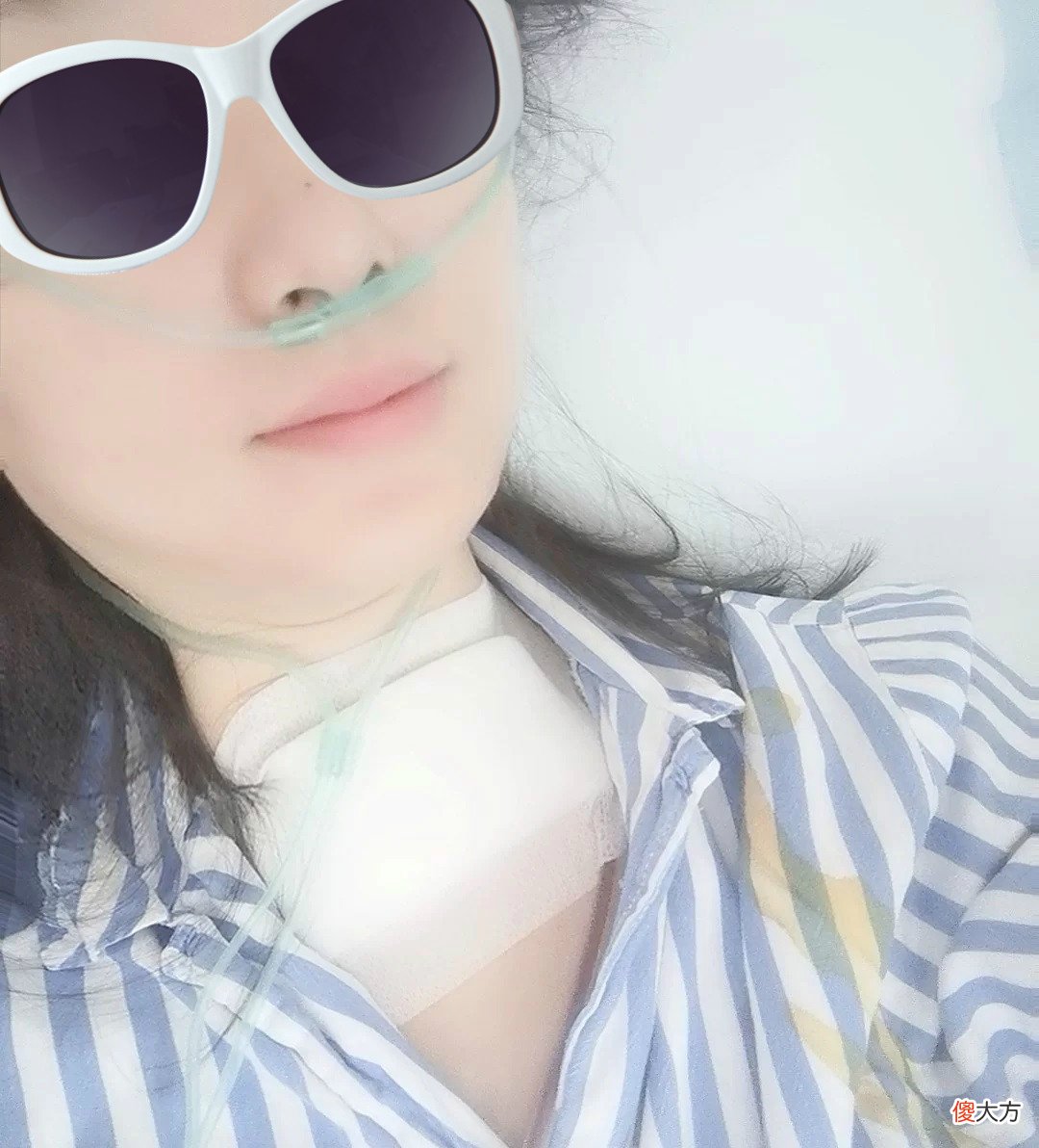 患者自述2019年前的体检，甲状腺结节基本都保持在0.4公分左右