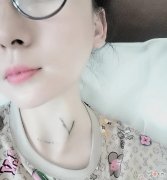 患者自述2019年前的体检，甲状腺结节基本都保持在0.4公分左右